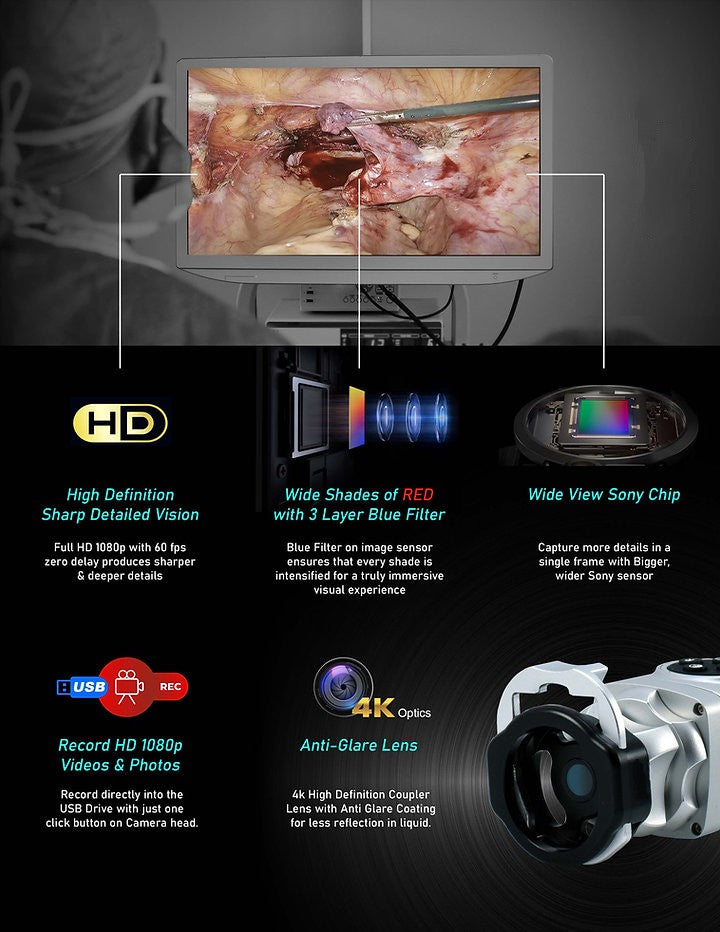 Endoscopy Laparoscopic Camera Full HD with Cold LED Light Source 120W