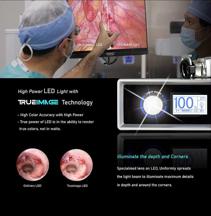 Endoscopy Laparoscopic Camera Full HD with Cold LED Light Source 120W