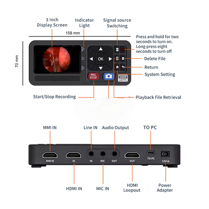 4K Medical Surgical Recorder for Laparoscopy